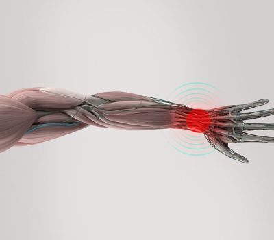 Anatomy model showing wrist pain. On plain studio background. Pain area shown in red.