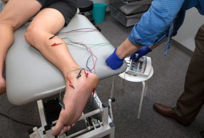 Dry-Needle-Therapy1