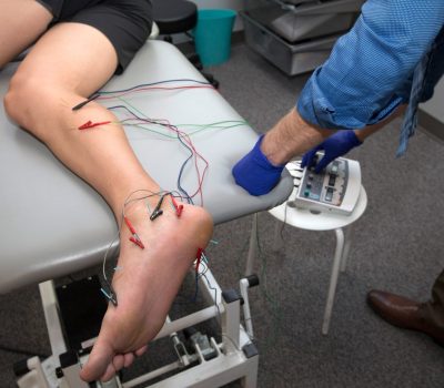 Dry-Needle-Therapy1