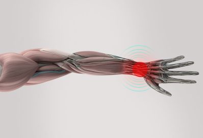 Anatomy model showing wrist pain. On plain studio background. Pain area shown in red.