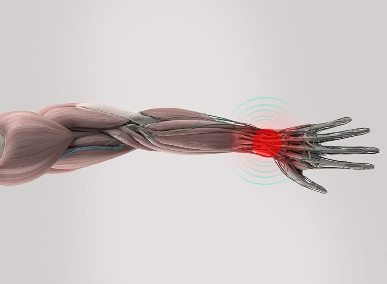 Anatomy model showing wrist pain. On plain studio background. Pain area shown in red.